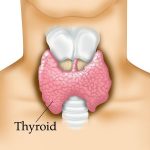 thyroid111